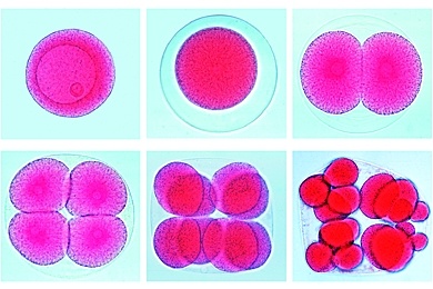 Mikropräparat - Seeigeleier, Entwicklung vom unbefruchteten Ei bis zur Gastrulation, gemischte Stadien im Streupräparat