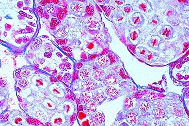 Mikropräparat - Meiose und Spermiogenese, Hoden vom Flußkrebs, Schnitt