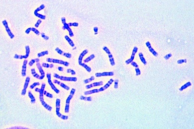 Mikropräparat - Menschliche Chromosomen aus Zellkultur, männlich