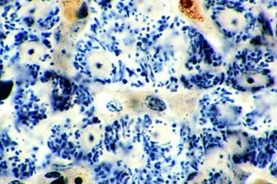 Mikropräparat - Mitochondrien in den Zellen von Leber oder Niere, Darstellung durch Spezialfärbung