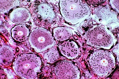 Mikropräparat -Golgi-Apparat in den Zellen des Spinalganglions, Darstellung durch Spezialfärbung