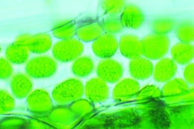Mikropräparat - Chloroplasten, Darstellung durch Spezialfärbung