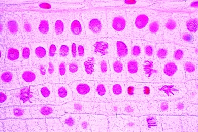 Mikropräparat - DNA in Zellkernen, Darstellung durch Feulgen-Reaktion
