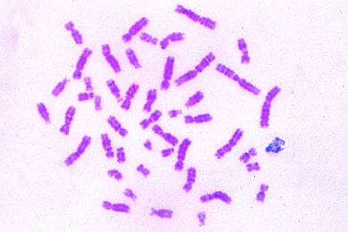 Mikropräparat - Chromosomen des Menschen im Metaphase-Stadium, ausgebreitet und einzeln identifizierbar