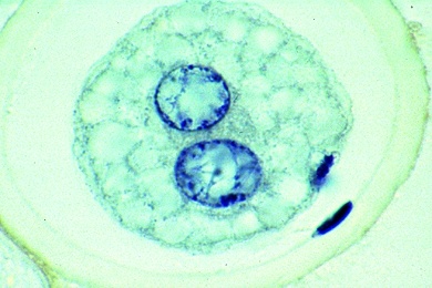 Mikropräparat - Reifeteilungen in den Eiern vom Pferdespulwurm (Ascaris) Eisenhämatoxylin-Färbung
