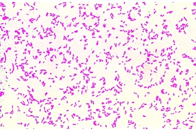 Mikropräparat - Eberthella typhi, Typhusbakterien, Ausstrich. Gramfärbung