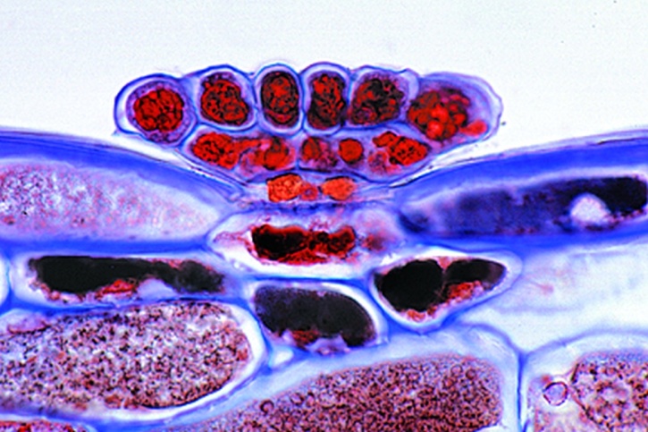 Mikropräparat - Fettkraut (Pinguicula), Blatt mit Drüsenhaaren, quer