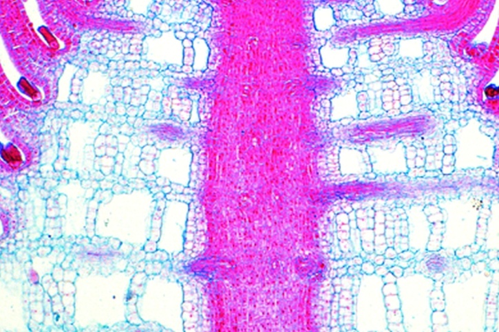 Mikropräparat - Tannenwedel (Hippuris), Stamm mit Luftkanälen, quer