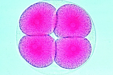 Mikropräparat - Seeigel Entwicklung (Psammechinus miliaris): Zwei-, Vier- und Acht-Zellen-Stadium
