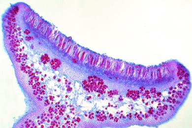 Mikropräparat - Xanthoria, Schüsselflechte, Apothezien mit Asci und Sporen, quer, Flechten (Lichenes)