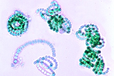 Mikropräparat - Anabaena, fadenförmige Blaualge mit Heterocysten, total Blaugrüne Algen (Cyanophyceae)
