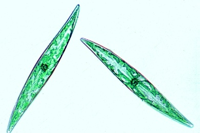 Mikropräparat - Diatomeen, gemischt, Darstellung des Zellinhaltes, Kieselalgen (Diatomeae)