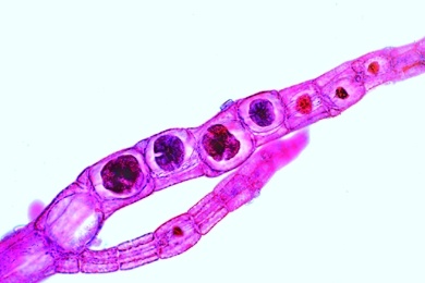 Mikropräparat - Polysiphonia, Rotalge, Thallus mit Tetrasporen, total, Rotalgen (Rhodophyceae)