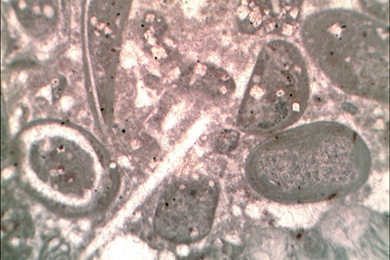 Kalkstein mit Crinoiden Stammzellen, Gesteinsdünnschliff Dauerpräparat