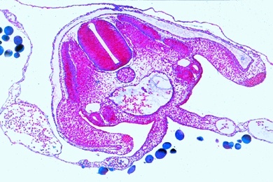 Mikropräparat - Huhn, Querschnitt durch die Kopfregion eines 3 Tage alten Keims, Gehirn- und Augenanlage, Herz
