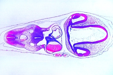 Mikropräparat - Huhn, Frontalschnitt durch einen 3 - 4 Tage alten Embryo: Anordnung der Organanlagen, Kiemenspalten, Urwirbel