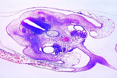 Mikropräparat - Huhn, Querschnitt durch die Kopfregion eines 4 - 5 Tage alten Embryos: Gehirnanlage, Kiemenbogen und Gefäße