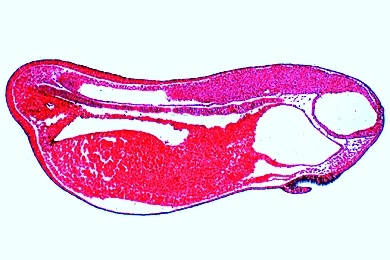 Mikropräparat - Frosch, Junges Schwanzknospen-Stadium, sagittal: Segmentierung des Mesoderms, Gehirnanlage, Urdarm