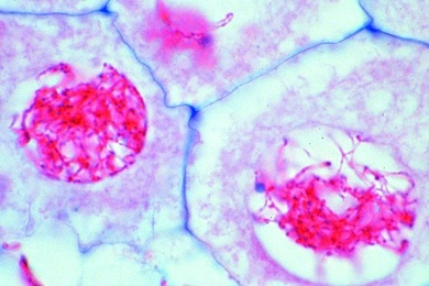 Mikropräparat - Lilie, Leptotän, Spiremstadium der Chromosomen. Alle Zellen mit diploidem Chromosomensatz