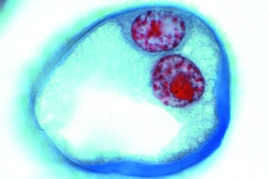 Mikropräparat - Lilie, Zweikernige (fertige) Pollenkörner nach erfolgter dritter Teilung mit generativem und vegetativem Kern