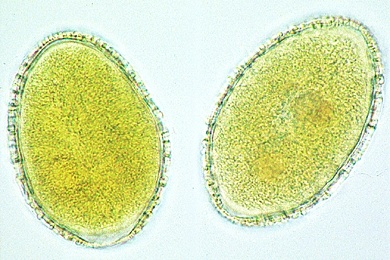 Mikropräparat - Lilie, Reife Pollenkörner, total. Oberflächenstruktur