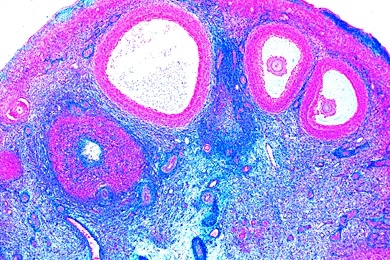 Mikropräparat - Eierstock (Ovarium), Mensch, quer