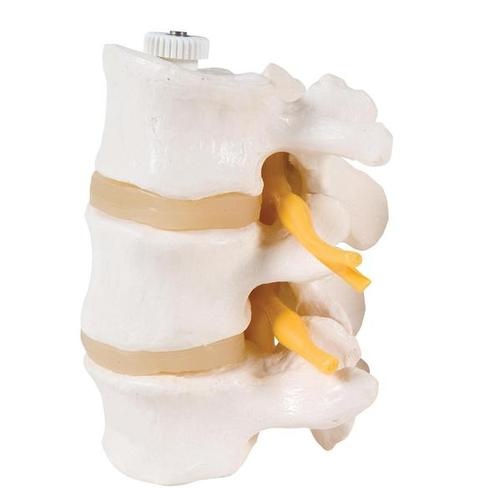 3 Lendenwirbel mit Spinalnerven und Rückenmark, elastisch montiert
