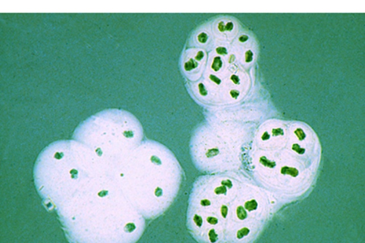Mikropräparat - Gloeocapsa, kleine Kolonien in Gallerthüllen