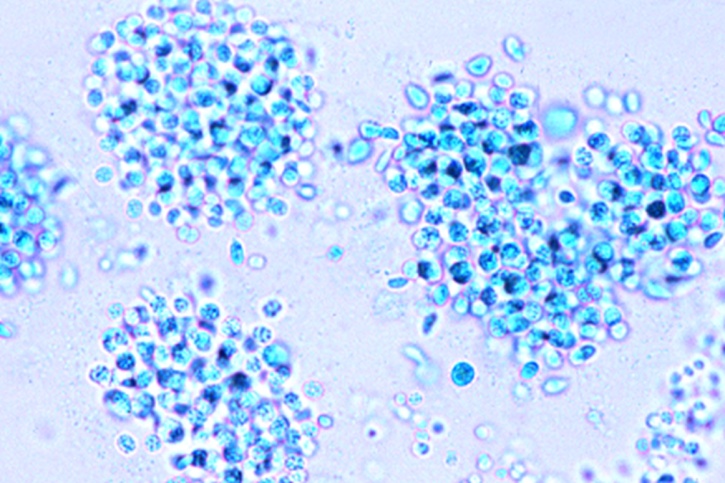 Mikropräparat - Microcystis, Wasserblüte
