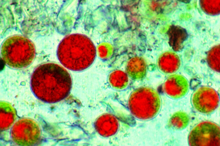 Mikropräparat - Haematococcus, Blutregenalge