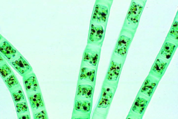 Mikropräparat - Ulothrix, unverzweigte Fäden mit gürtelförmigen Chloroplasten