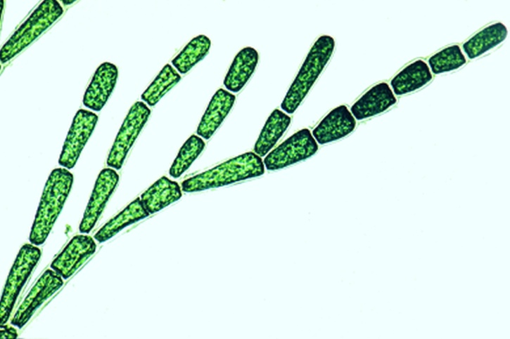 Mikropräparat - Cladophora, verzweigte Fäden mit vielkernigen Zellen