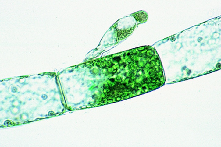 Mikropräparat - Oedogonium, nanandrisch, mit Zwergmännchen