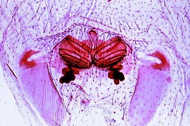 Mikropräparat - Spinne, Epigyne des Weibchens, total *