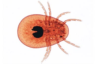 Mikropräparat - Ixodes (Ixodidae), Zecke, Imago total *