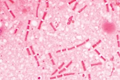 Mikropräparat - Bacillus anthracis. Ausstrich von Kultur