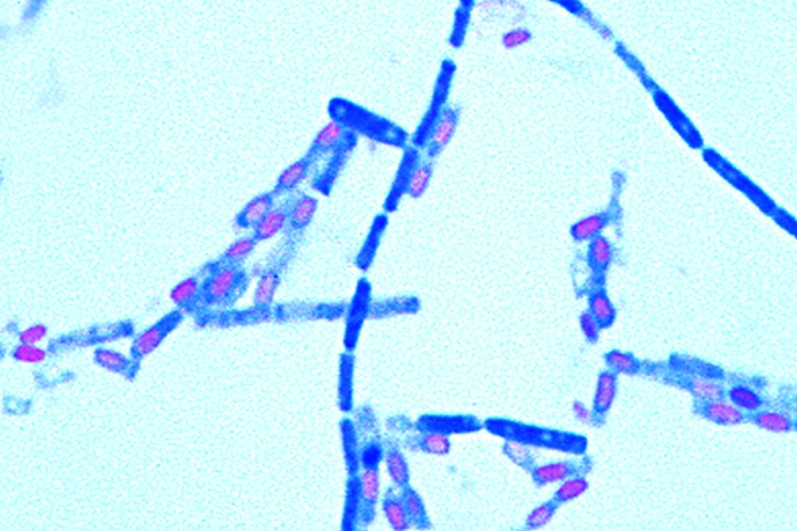 Mikropräparat - Clostridium septicum. Pararauschbrand. Ausstrich