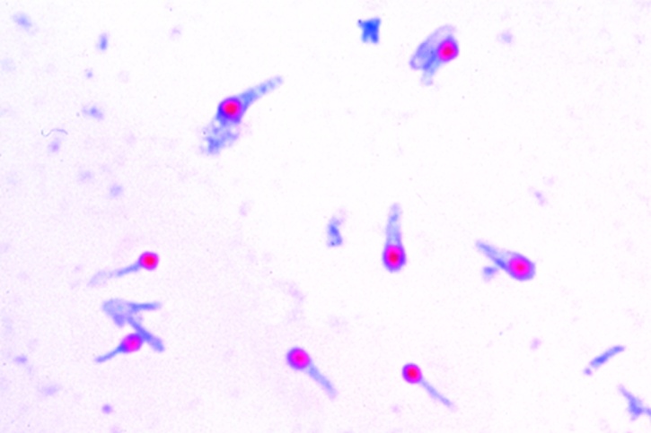 Mikropräparat - Clostridium tetani, Sporenfärbung nach Ziehl-Neelsen