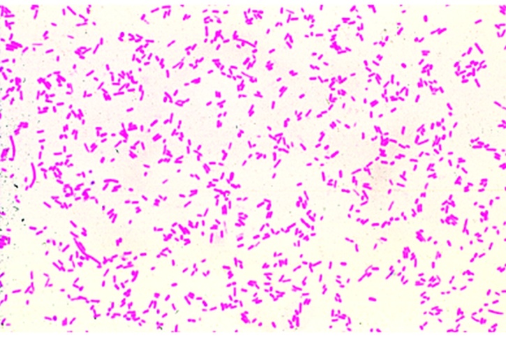 Mikropräparat - Eberthella typhi. Typhuserreger. Ausstrich