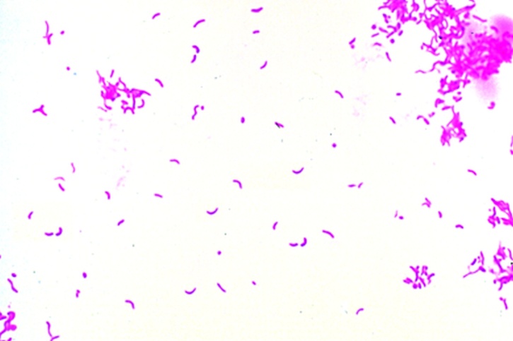Mikropräparat - Vibrio comma. Erreger der asiatischen Cholera. Ausstrich