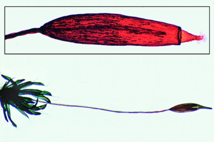 Mikropräparat - Tortula, Gametophyt und älterer Sporophyt mit Peristomzähnchen