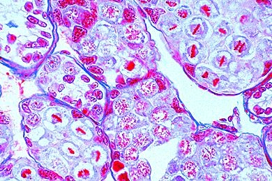 Mikropräparat - Astacus, Hoden mit Spermiogenese, speziell ausgesucht und gefärbt für Meiose- und Mitose-Stadien *
