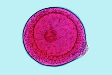 Mikropräparat - Psammechinus miliaris, Seeigel-Embryologie, unbefruchtete Eier
