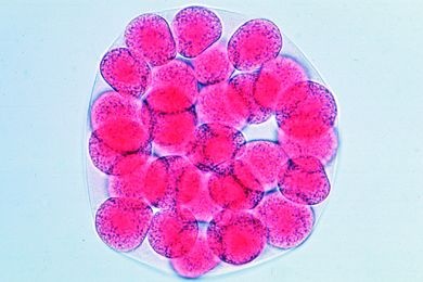 Mikropräparat - Psammechinus, Zweiunddreißig-Zellen-Stadium