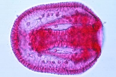 Mikropräparat - Psammechinus, Blastula, fortgeschrittene Gastrulation