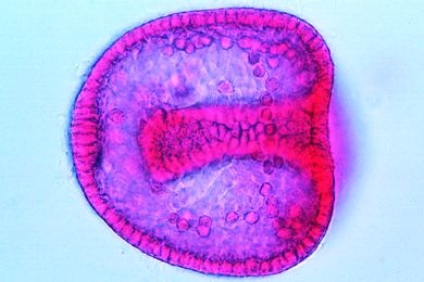 Mikropräparat - Psammechinus, Blastula, beginnende Gastrulation