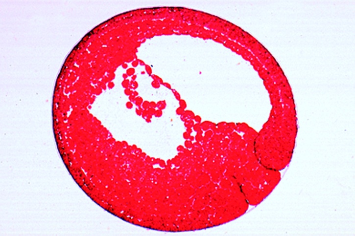 Mikropräparat - Frosch, Ältere Gastrula (Dotterpfropfstadium), sagittaler Längsschnitt. Keimblätter, Dotterpfropf, Blastocoel und Urdarmhöhle
