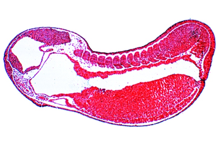 Mikropräparat - Frosch, Junges Schwanzknospenstadium, sagittaler Längsschnitt