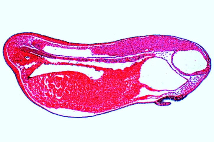 Mikropräparat - Frosch, Junges Schwanzknospenstadium, medianer Sagittalschnitt, Urdarm, Chorda, Gehirnanlage, Neuralrohr