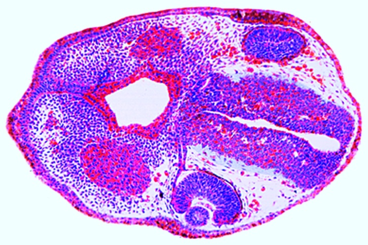 Mikropräparat - Frosch, Älteres Schwanzknospenstadium, Querschnitt durch die Kopfregion